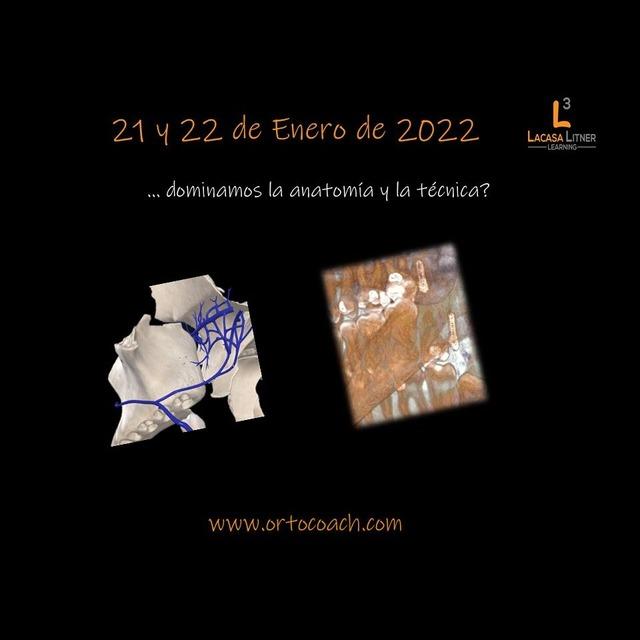 Formación: Curso Invisalign y minitornillos 21 y 22 de enero de 2022