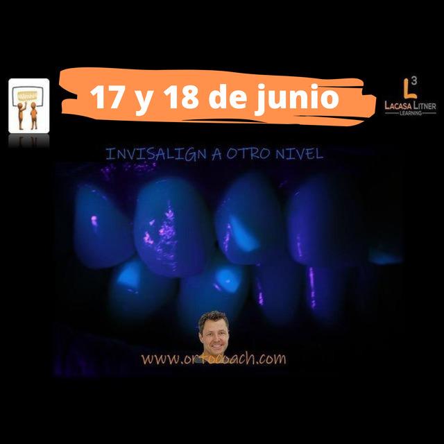 Formación: Curso Invisalign a otro nivel. 17 y 18 de Junio 2022