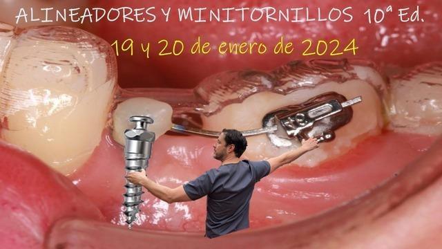 Formación: Curso Alineadores y minitornillos 19 y 20 de Enero 2024