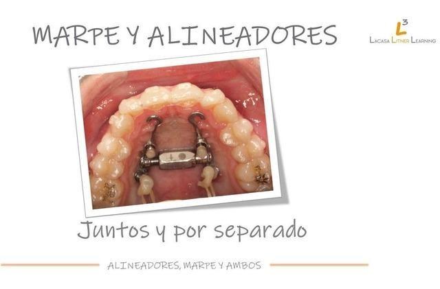 Formación: Curso 'MARPE Y ALINEADORES II' 25-26 Octubre 2024