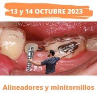 Formación: Curso Alineadores y minitornillos 13 y 14 de octubre 2023