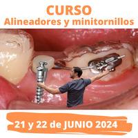 Formación: Curso Alineadores y minitornillos 21 y 22 de Junio 2024