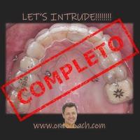 Formación: Curso minitornillos & Invisalign 19 y 20 de febrero de 2021