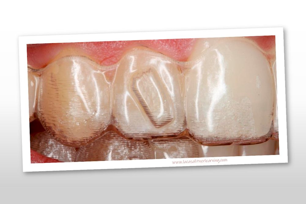 Curso de ortodoncia L3 22 y 23 de Enero 2021 *COMPLETO*